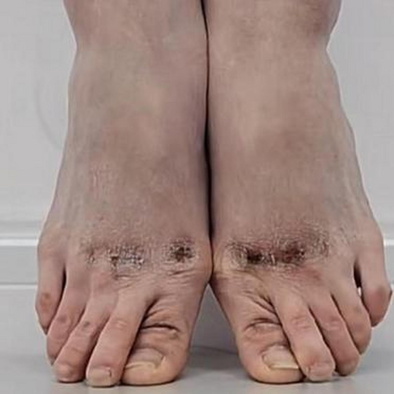 舞蹈生的脚真是伤痕累累啊,台上十分钟,台下十年功!