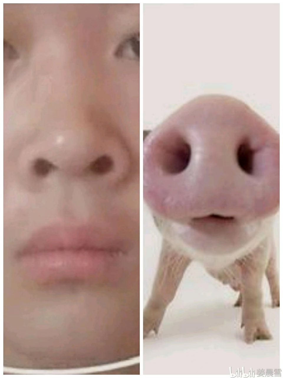 1,朝天鼻 正面看,鼻孔朝天,侧面看鼻尖朝天,类似猪猪鼻 2,驼峰 