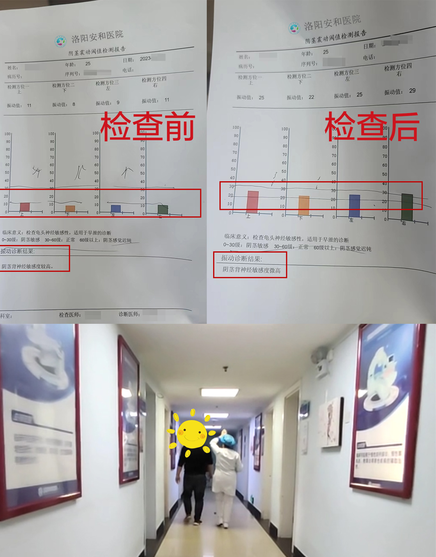 前列腺液正常值表图片图片