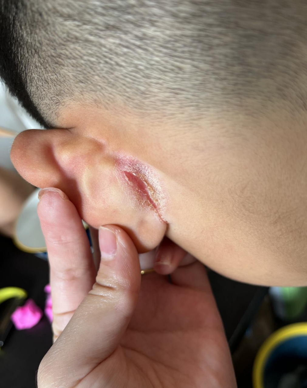 小孩子耳朵后面这是什么?有人懂得吗?