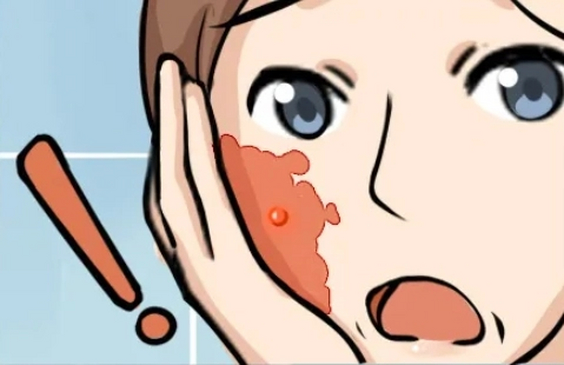 什么是鲜红斑痣?