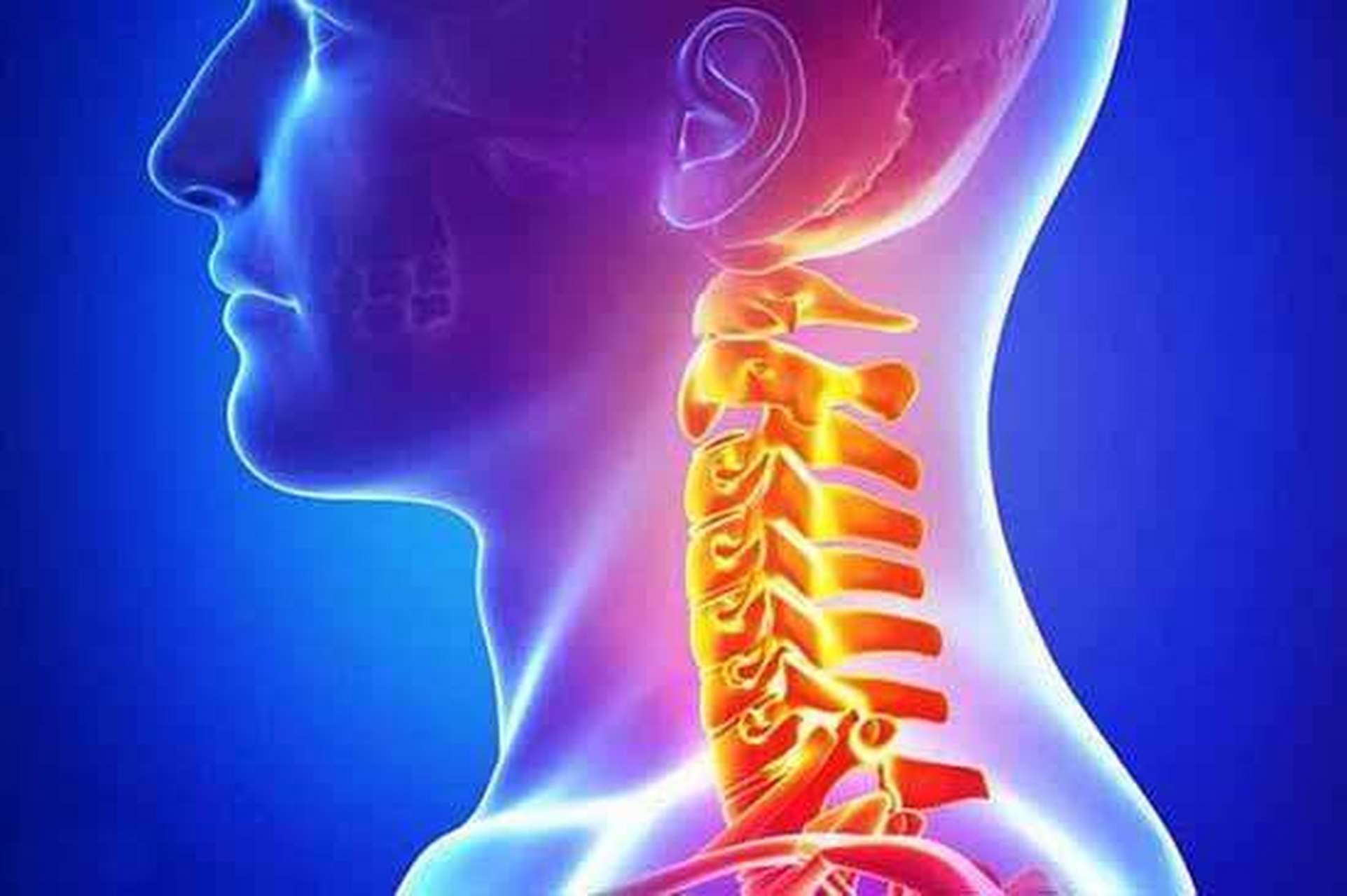 颈椎病又被称为颈肩综合征,是由于颈椎以及周围的软组织发生病理改变