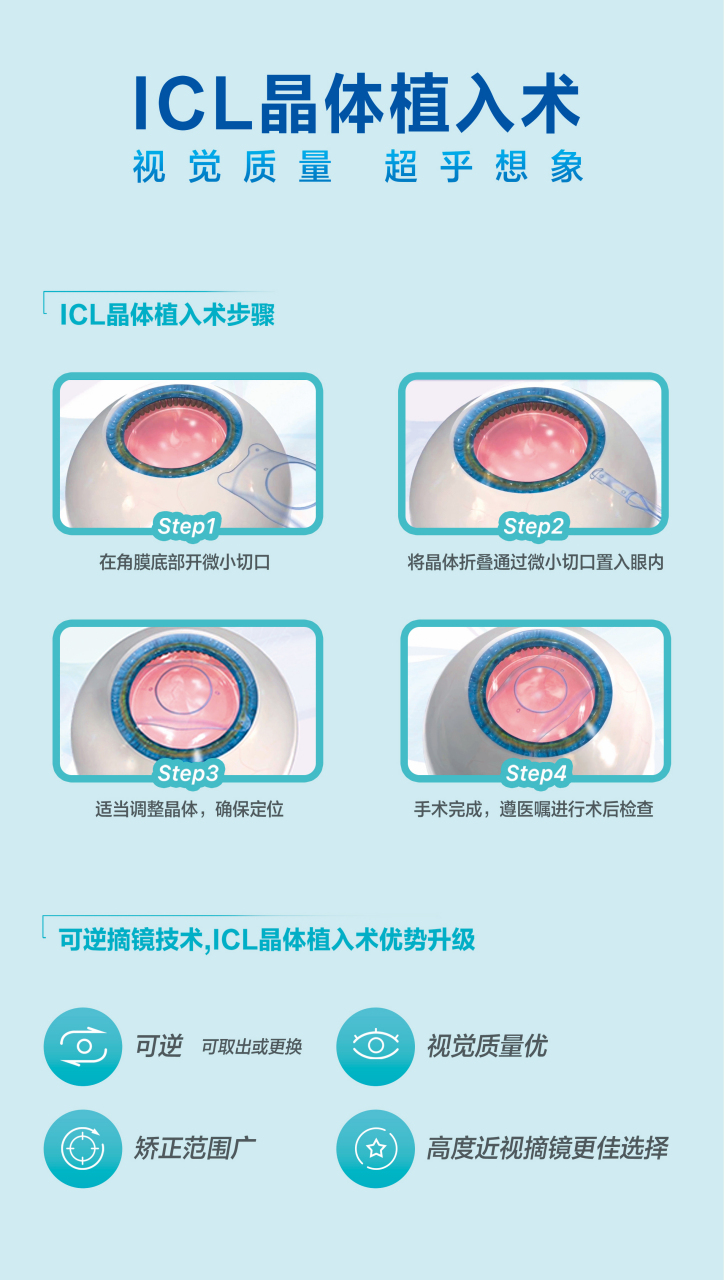 近视手术前景无限：未来视界的新篇章