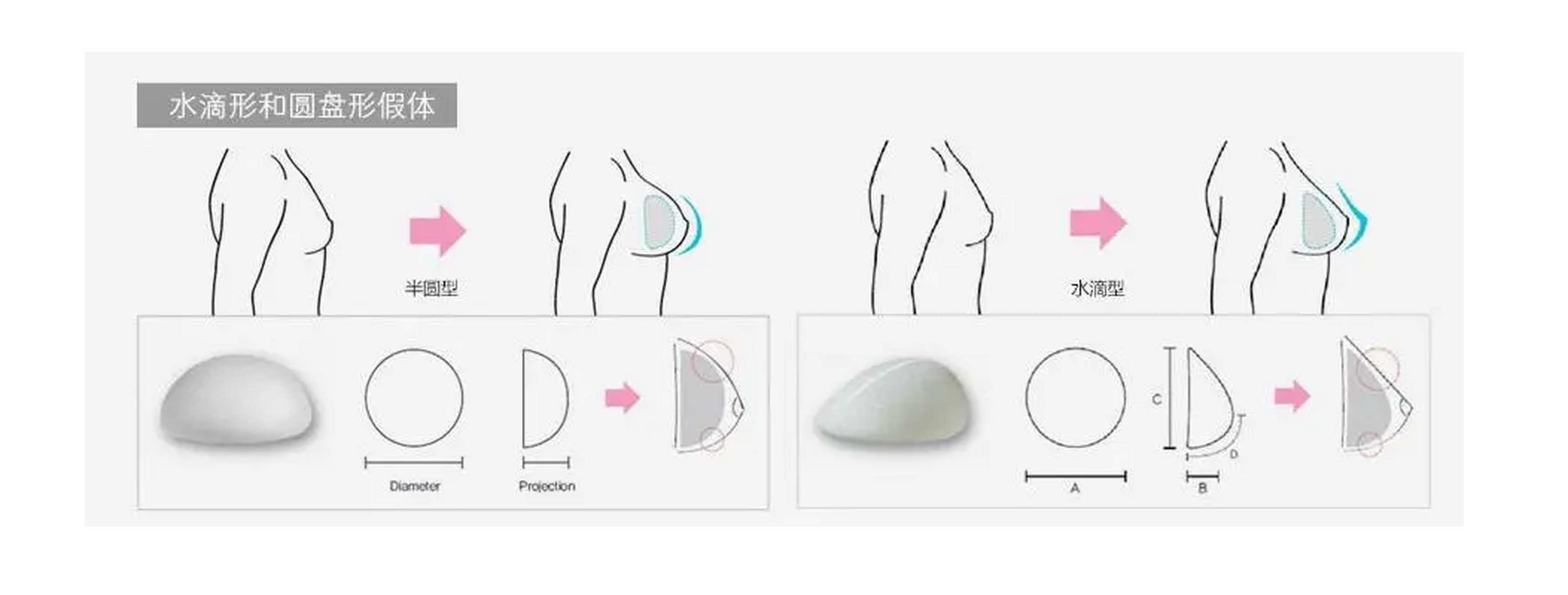 5公分或者隆胸手术失败,胸部罩杯在b杯以下的女性朋友.