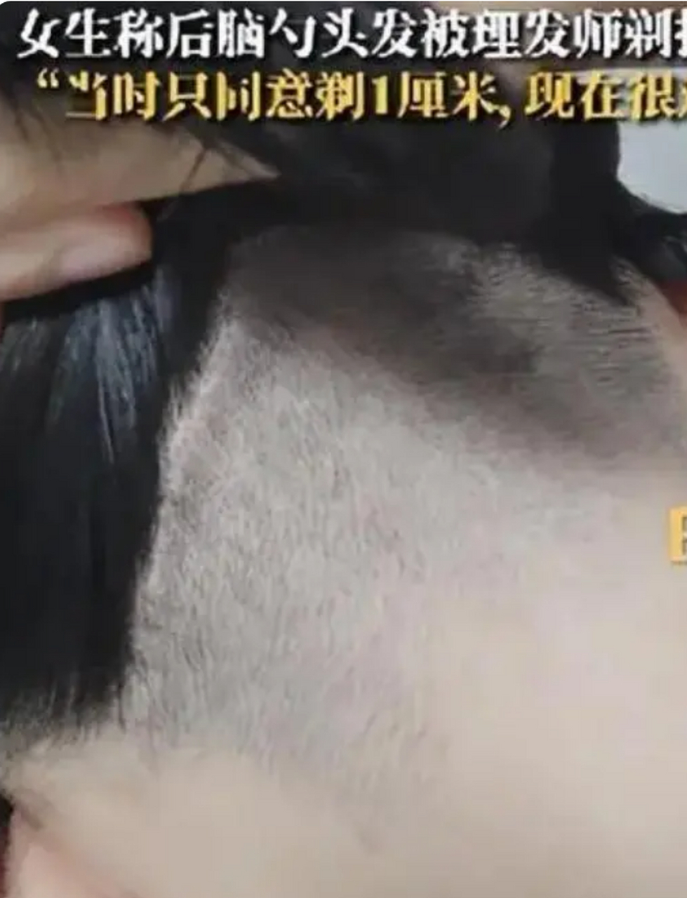女子后脑勺头发被理发师剃掉一半.