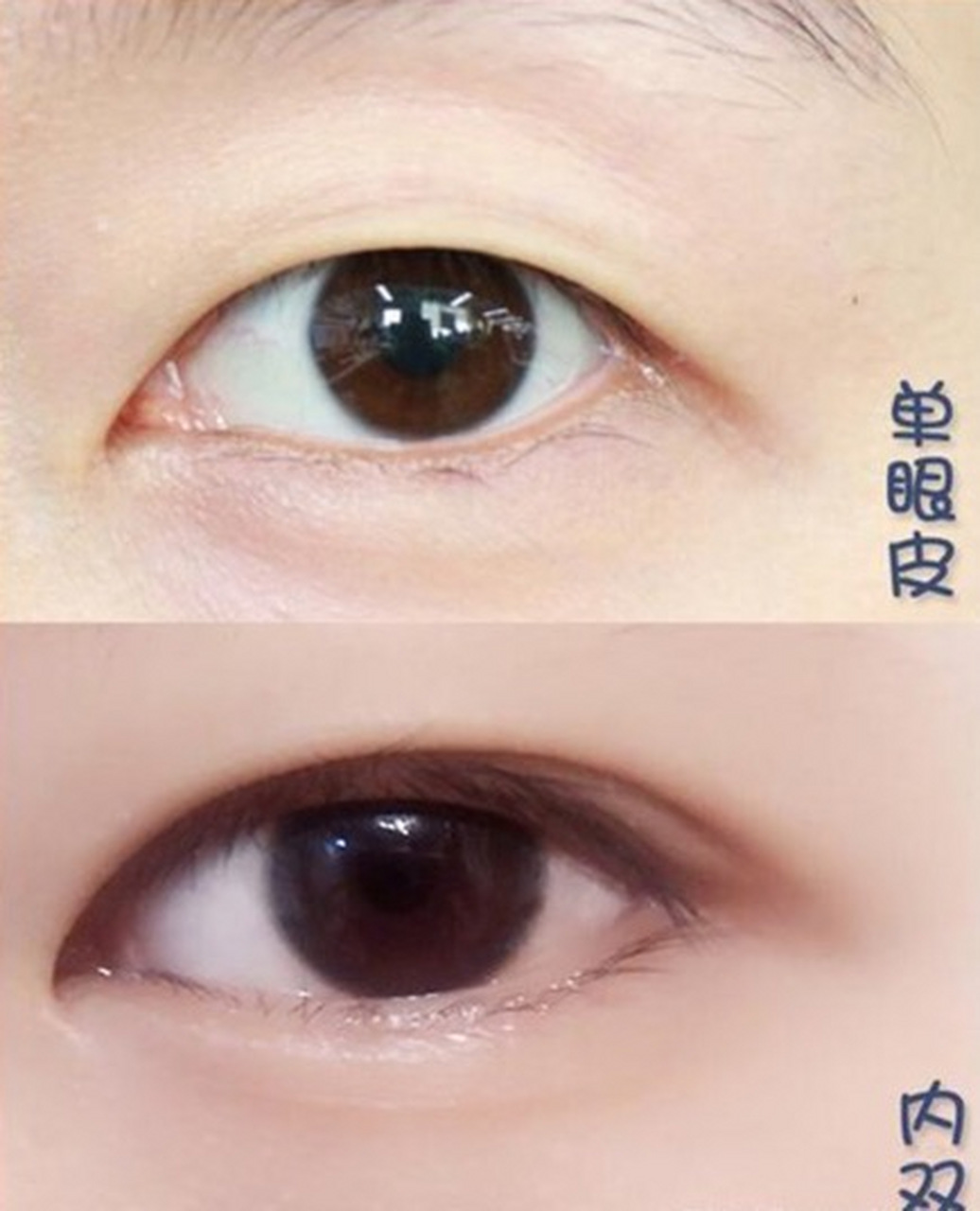 怎么区分单眼皮和内双?