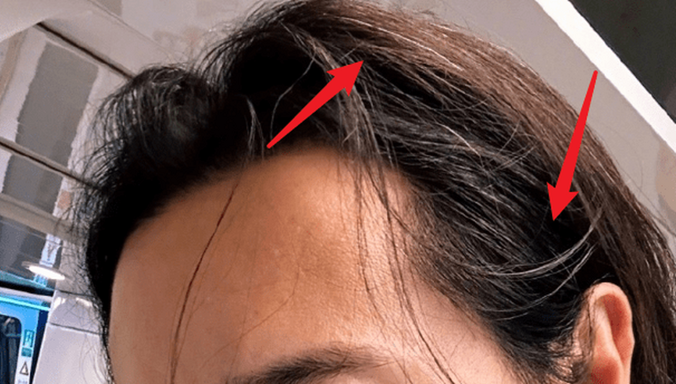 40岁高云翔近况曝光,经济拮据头发胡子白了不少,越来越女性化   近日