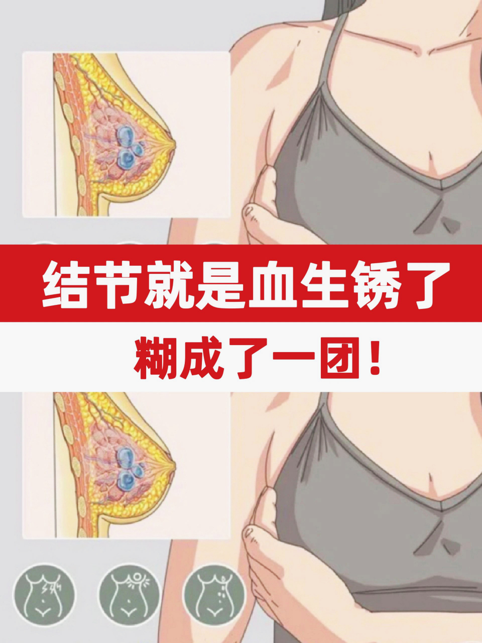 乳腺结节照片图片