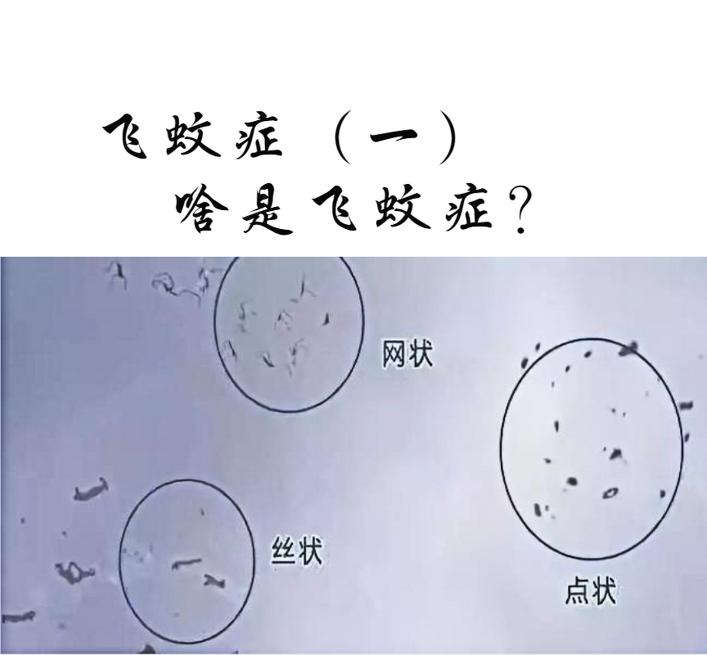 飞蚊症卡通图片