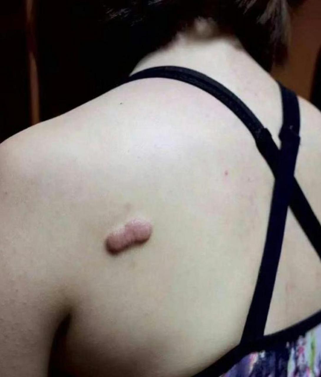 这种纹身还挺有创意的,可以把疤痕遮住