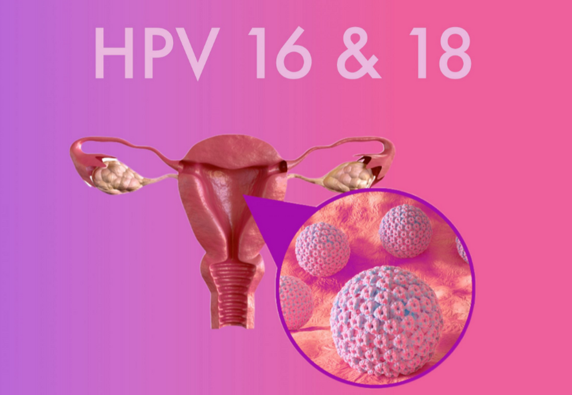 hpv,是一种较为常见的病毒,能导致皮肤或粘膜上生长出尖锐湿疣