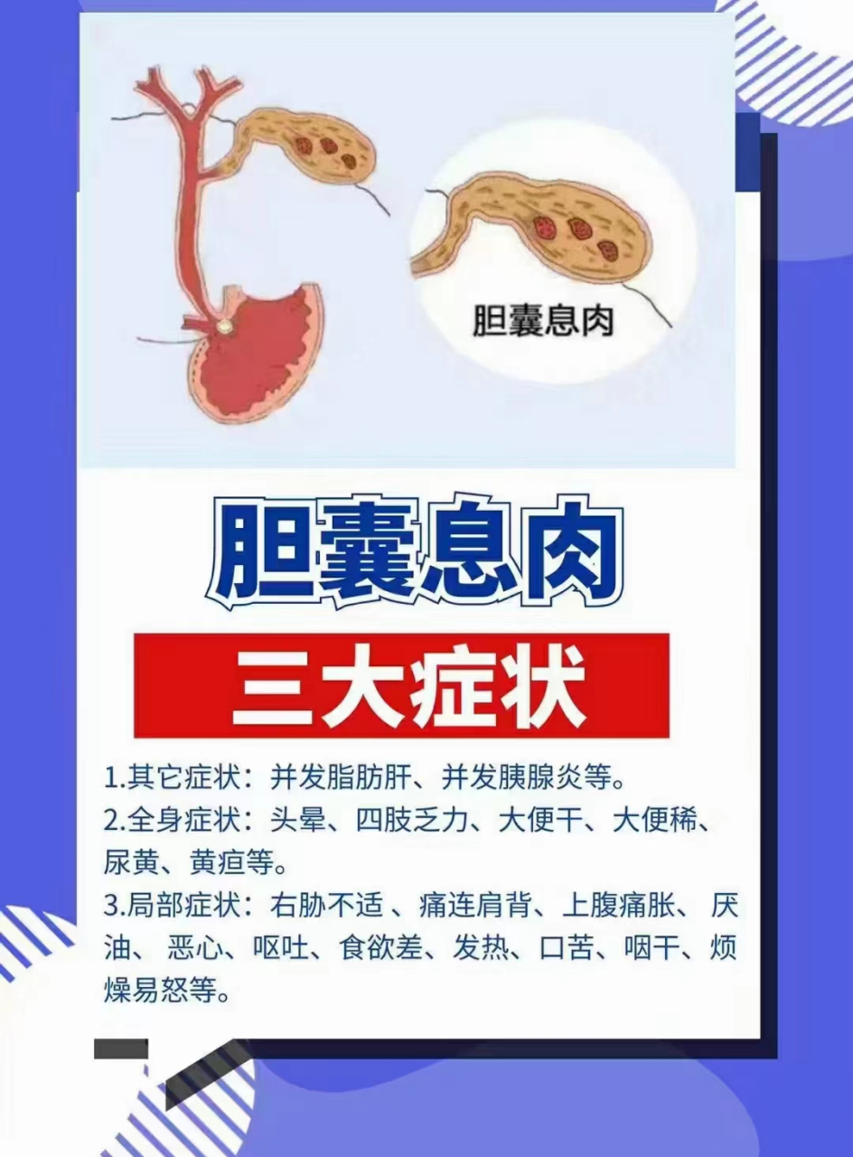 胆囊息肉有什么症状图片