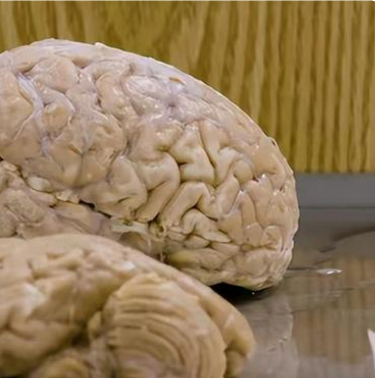 哈佛脑组织资源中心收集了9000多个人类大脑,切片储存,成为僵尸最惦记