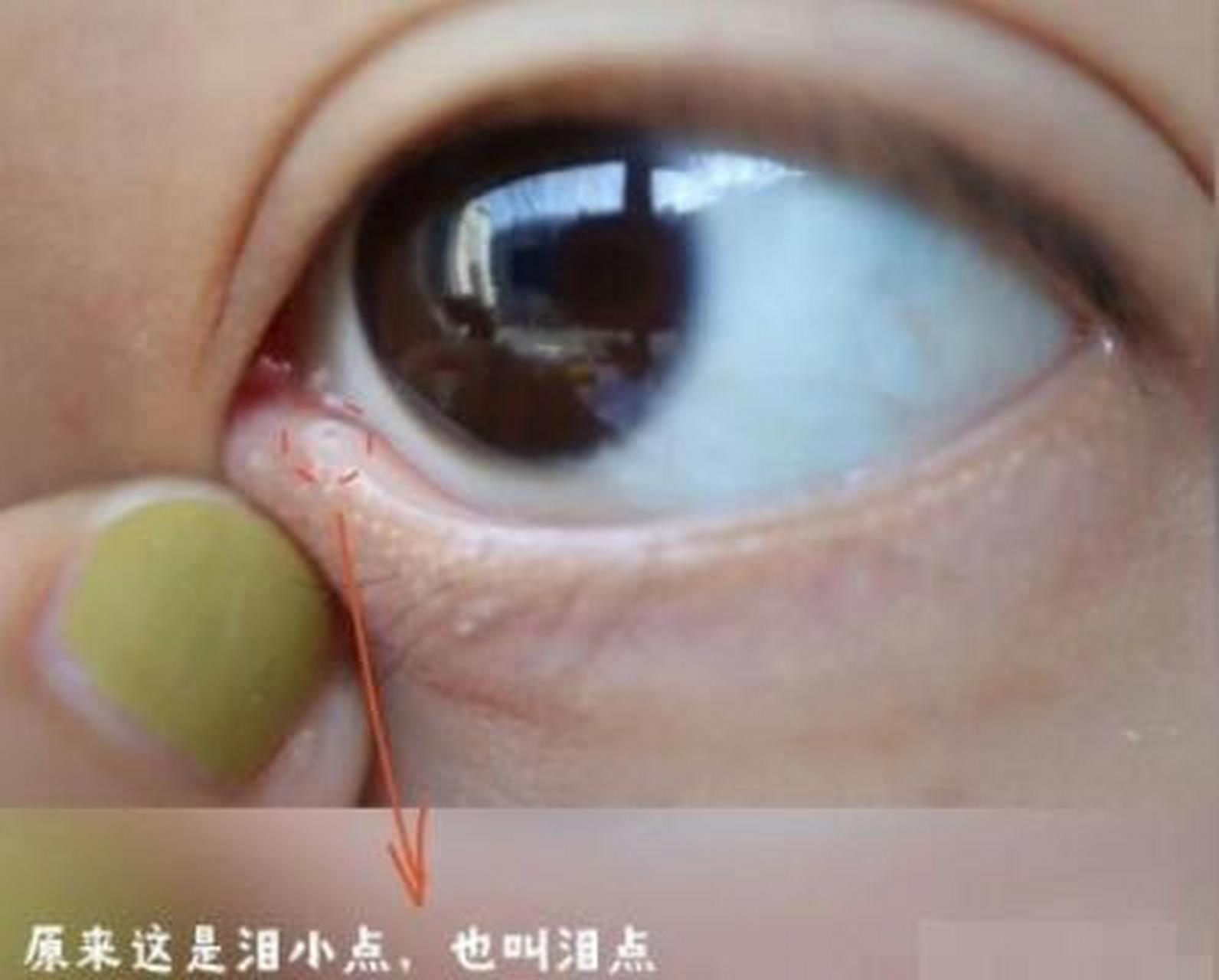 泪点其实就是眼皮靠近眼角处的小孔,医学上叫做"泪小点"  这个小孔