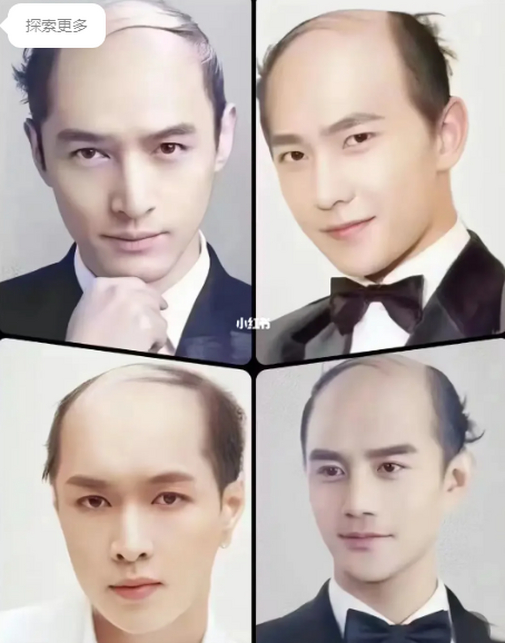 我朋友圈的植发广告…哈哈哈哈好