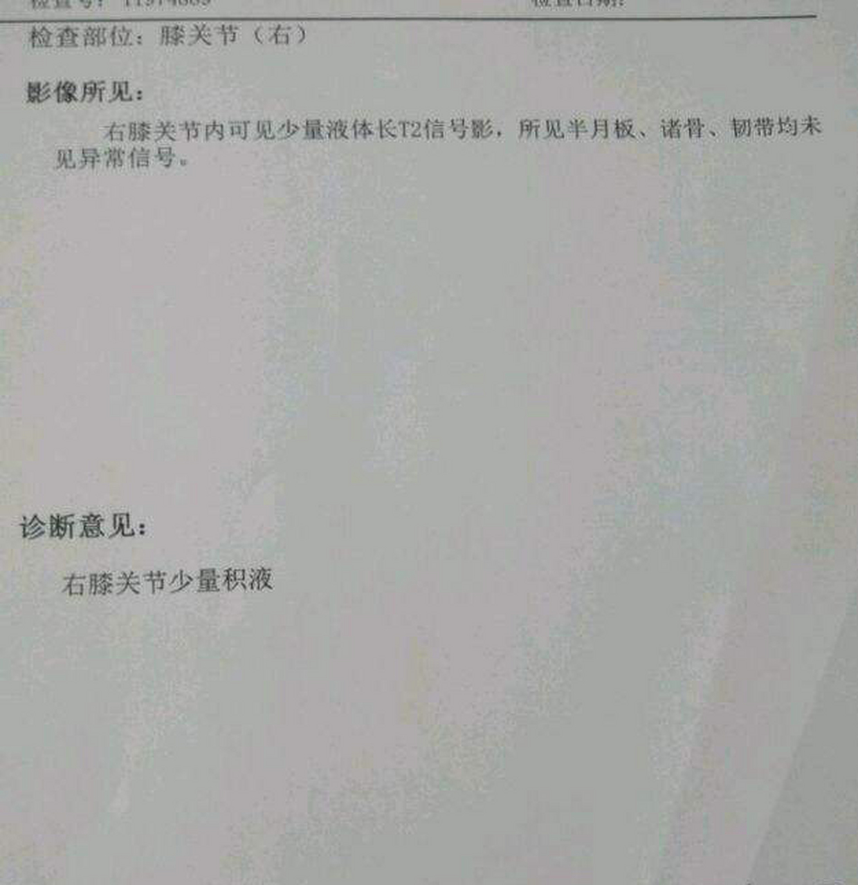 磁共振报告显示膝关节少量积液怎么办?