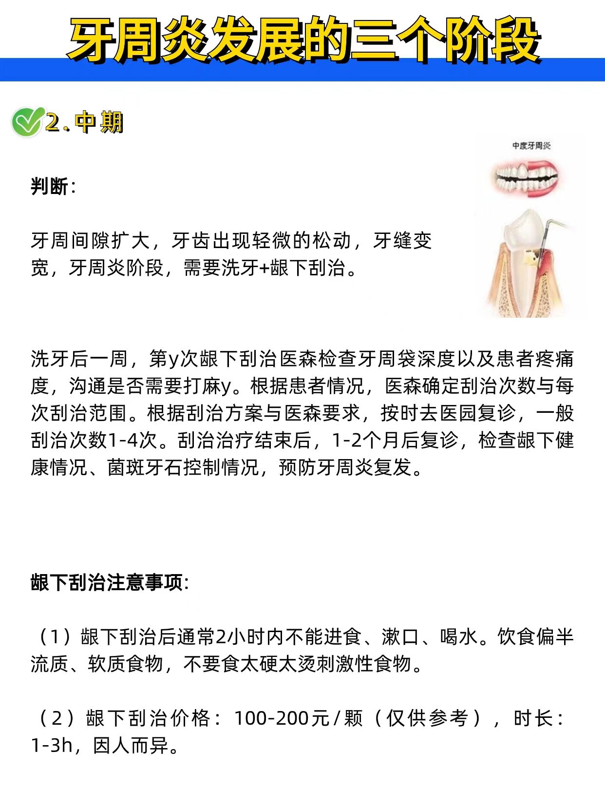 1分种带你了解牙周炎阶段及治疗方法!