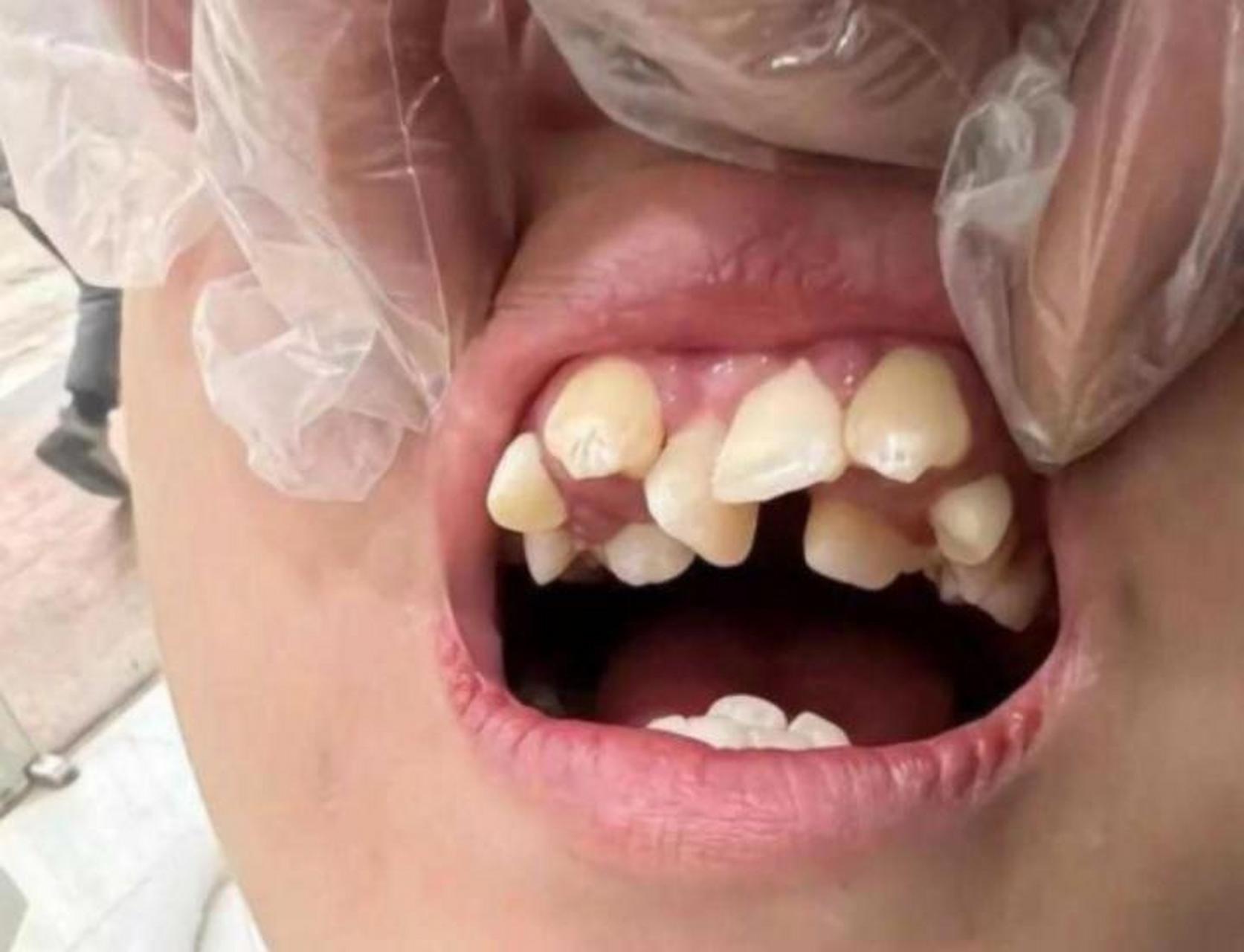 妹子这牙去演龅牙妹都不用化妆了[没眼看]