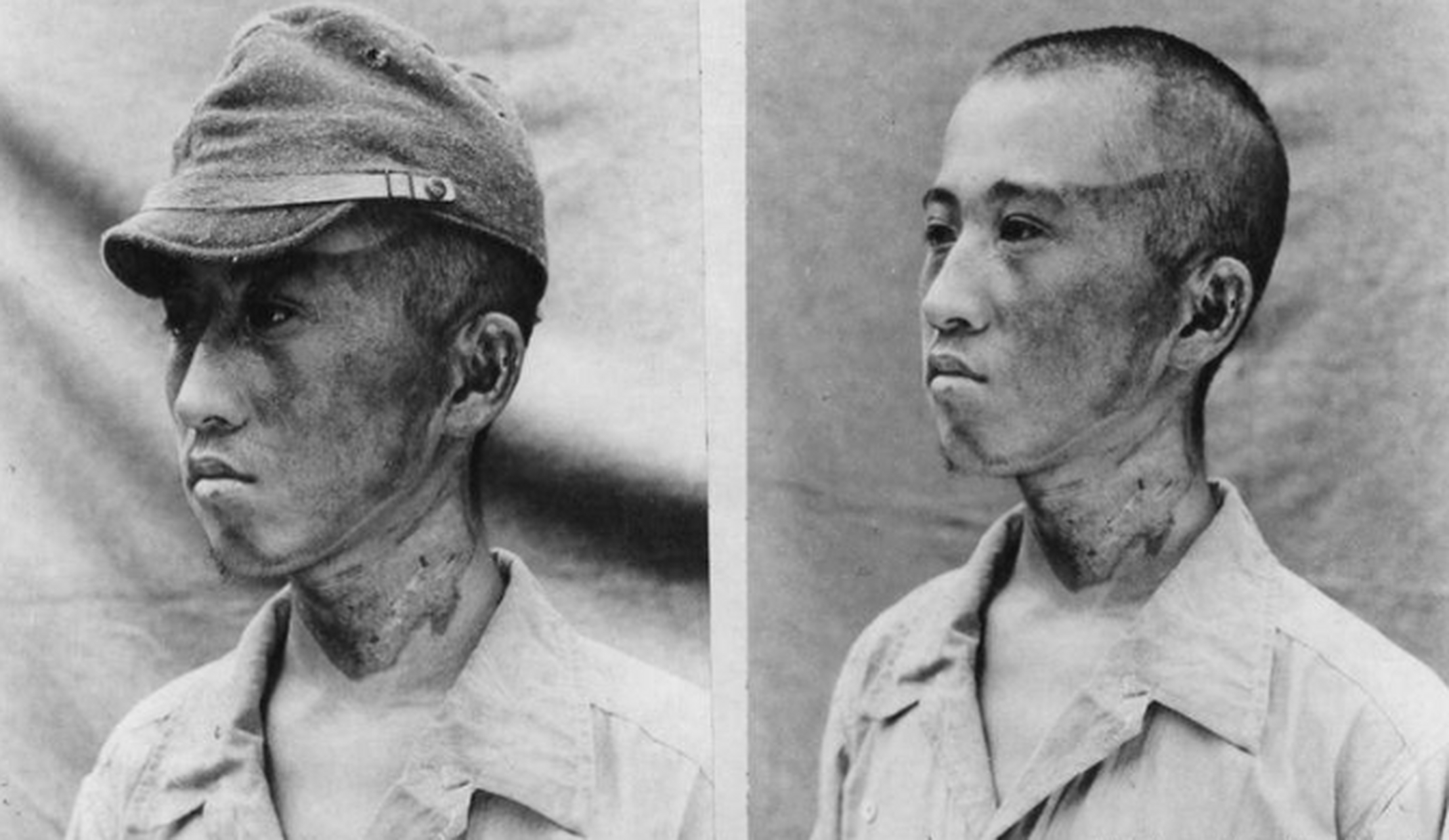 日本广岛核爆幸存者:眼睛瞬间烧成两窟窿,基因突变怪病层出不穷 1945