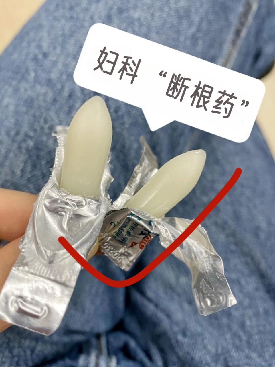 hpv或清0  1,yd炎——【双唑泰栓】 威力:消y,抑jun 适宜什么症状