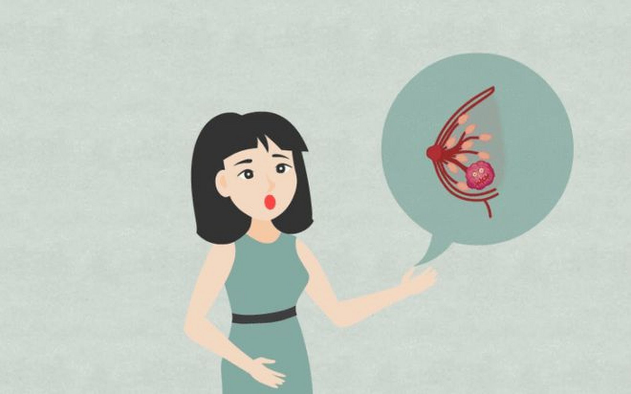 乳腺结节会发展成乳腺癌  多数的乳腺结节都是良性的,但是乳腺癌的