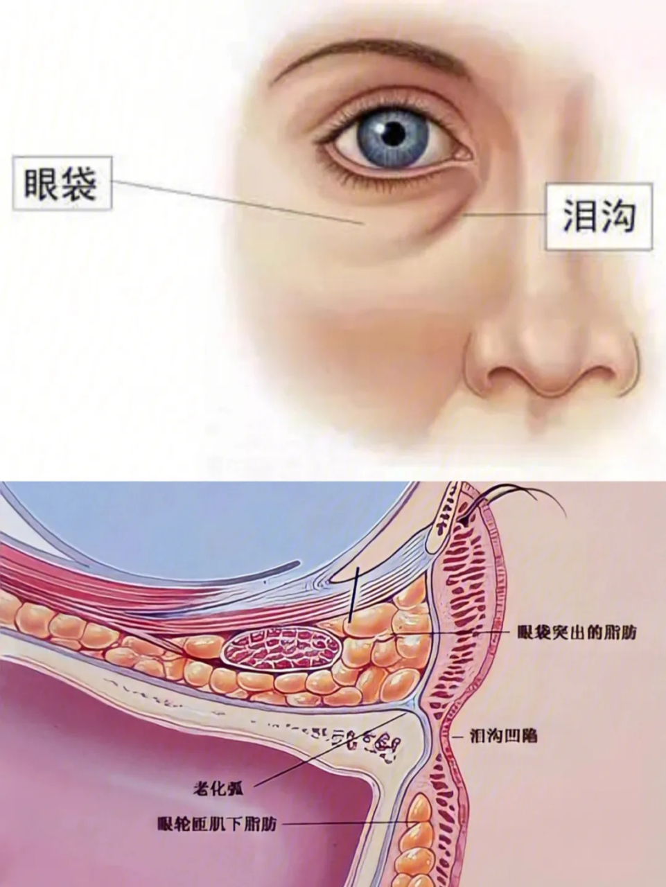 眼袋结构图并带名称图图片