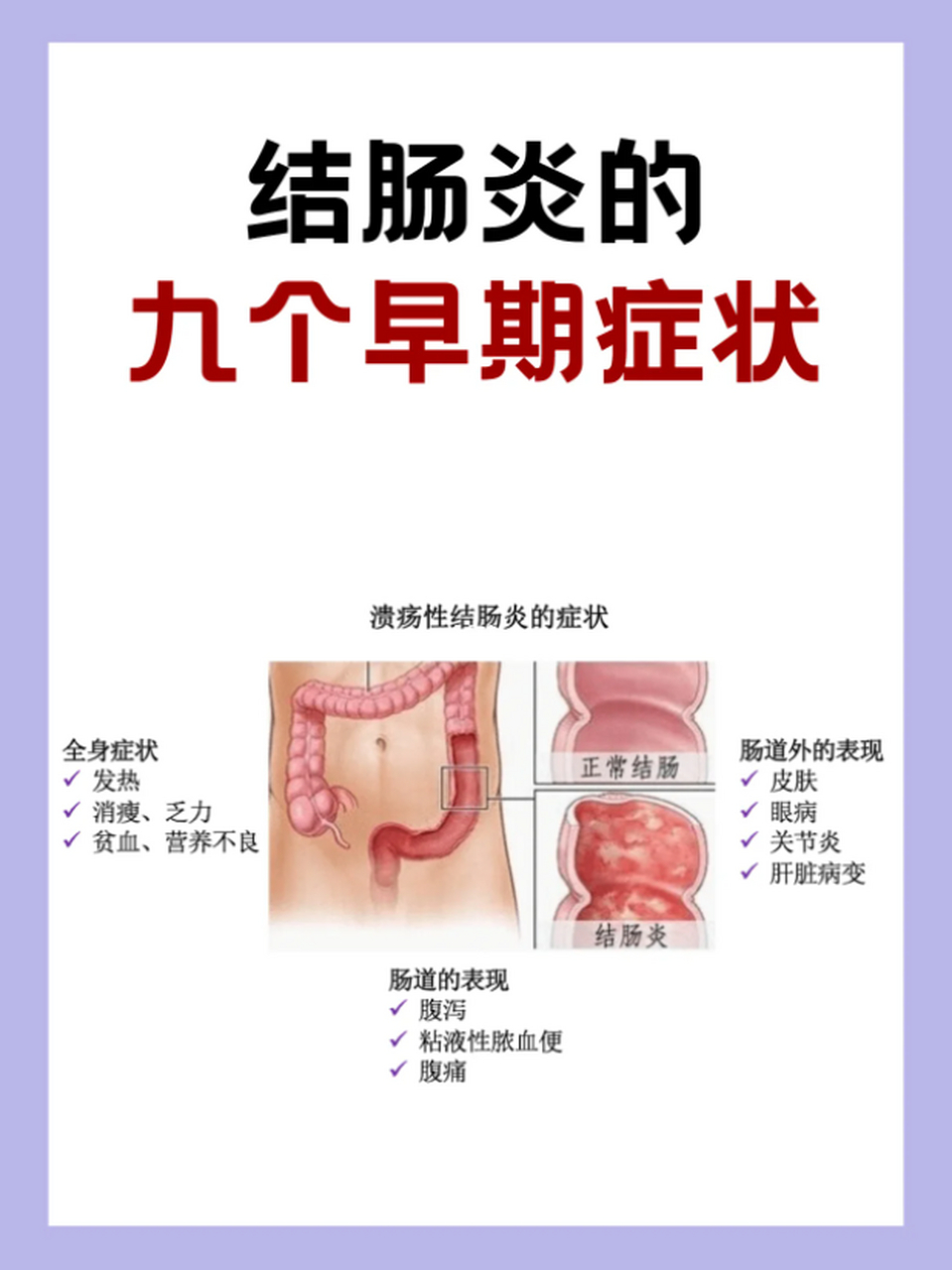 结肠炎的91566个早期症状,千万别忽视75 98腹痛:大部分左边