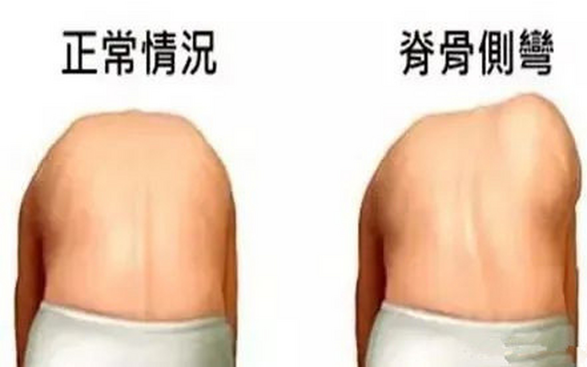 由于儿童脊柱在发育过程中很多骨骼都还没闭合,反复弯腰,劈叉等动作