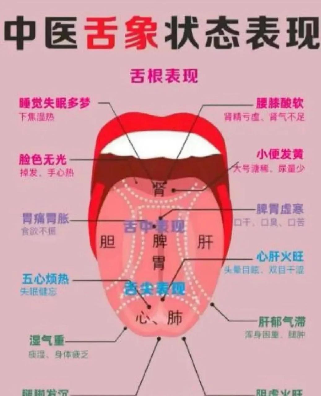 中医基础理论舌对照图片,喜欢的可以收藏[比心][比心]