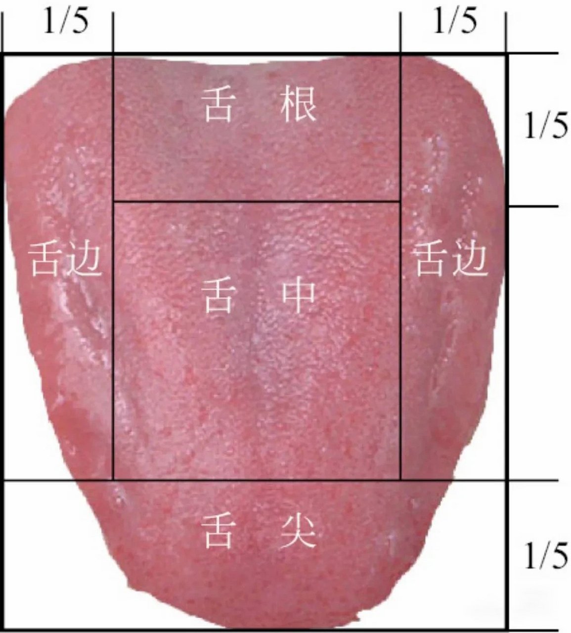 不同部位的舌苔代表不同的症状 舌头,是人体的一个缩影,五脏六腑有