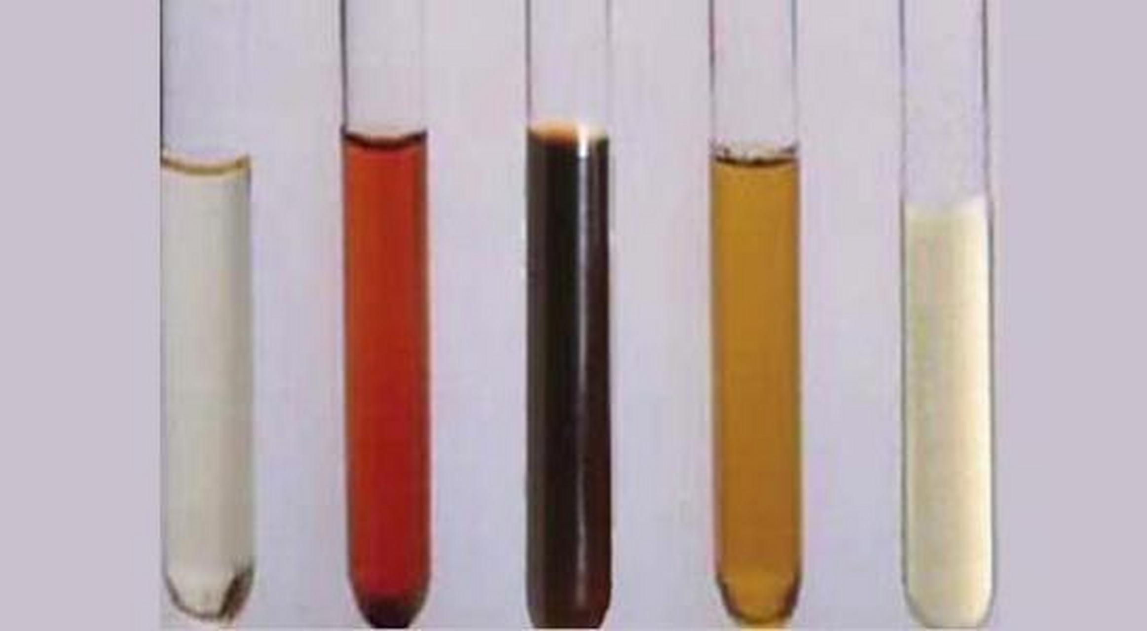 尿滴白是慢性前列腺炎的一个显著症状,排便时滴出来的液体是前列腺液