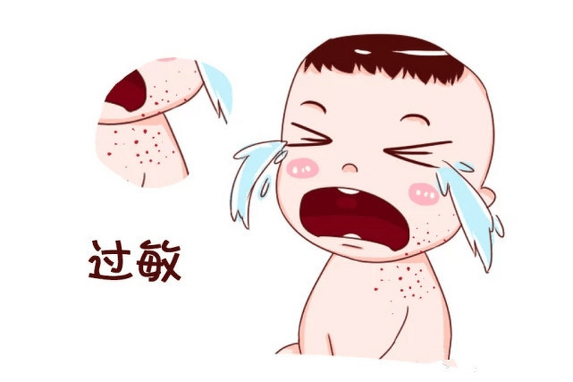 现在越来越多的孩子出现过敏,比如说过敏性鼻炎,这可能跟家长吸烟