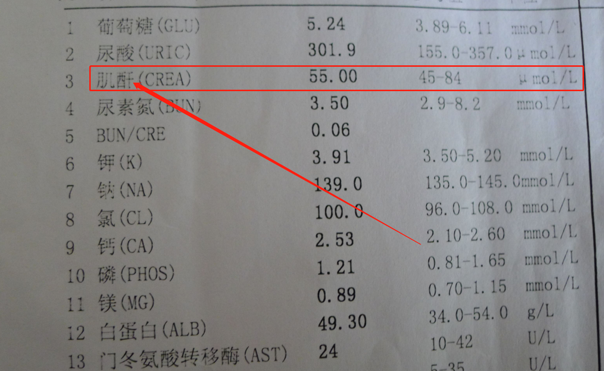 血肌酐检查图片