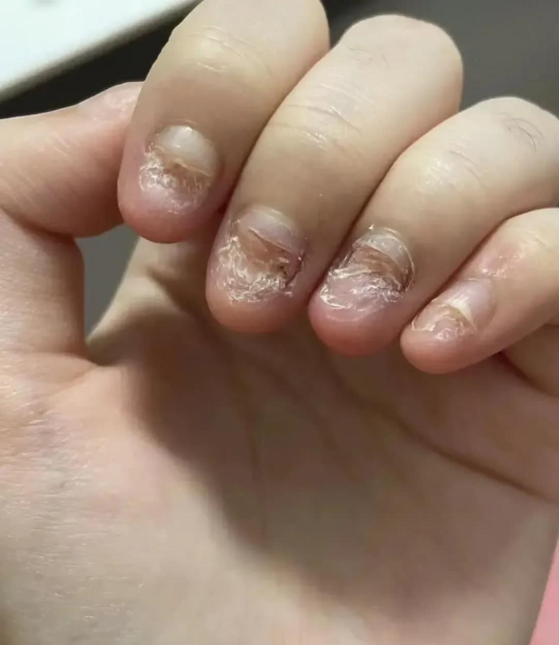 孩子咬指甲的坏习惯一定要改掉