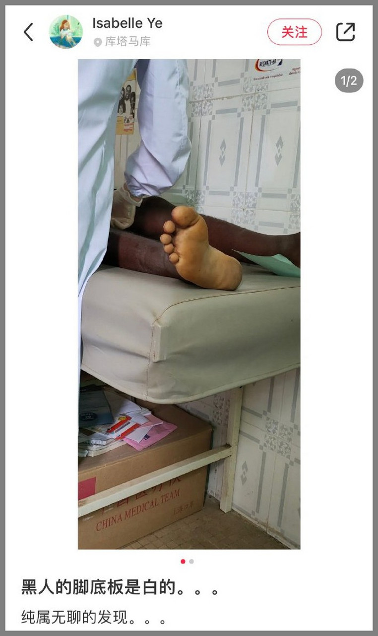 95:黑人的脚底是白的.