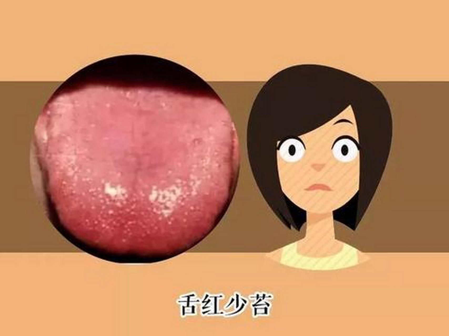 10秒自测你的肝脏是否健康: 1,舌红少津,脉弦或脉细数 2,头疼头胀,眼