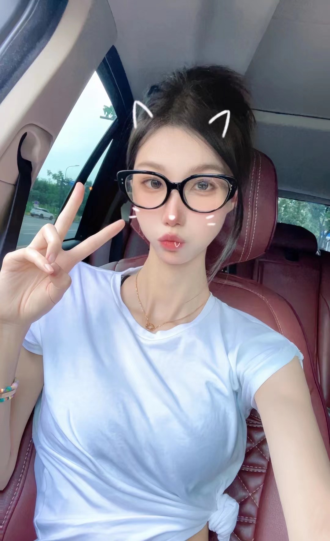 上去嘴巴也跟着凸直到现在感觉越来越凸有时候还会不小心咬到下嘴唇