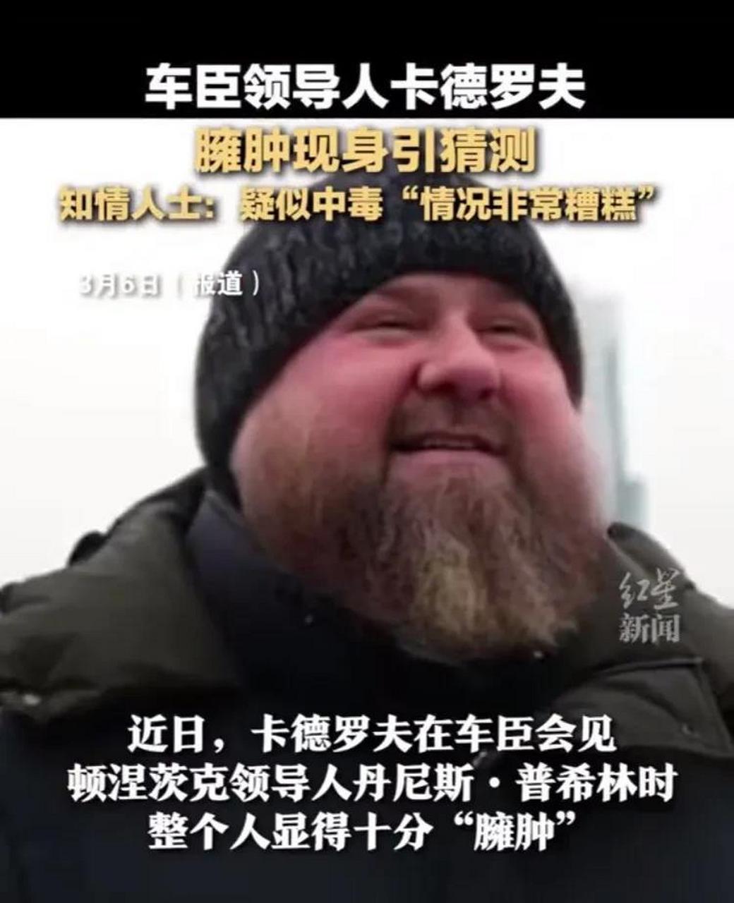 网传车臣总统卡德罗夫疑似已经中毒,导致严重的肾脏问题.