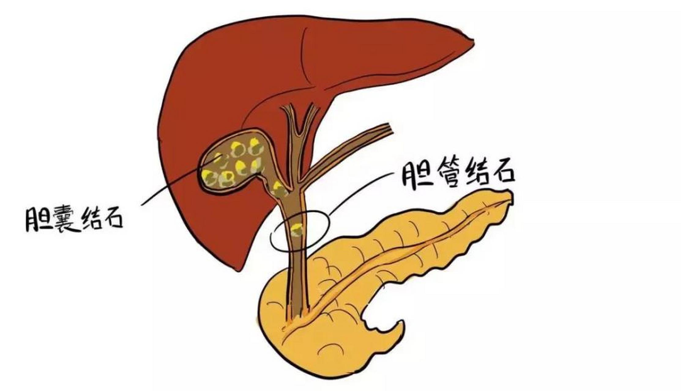 胃疼和胆囊疼的区别,别再盲目大意,需谨慎