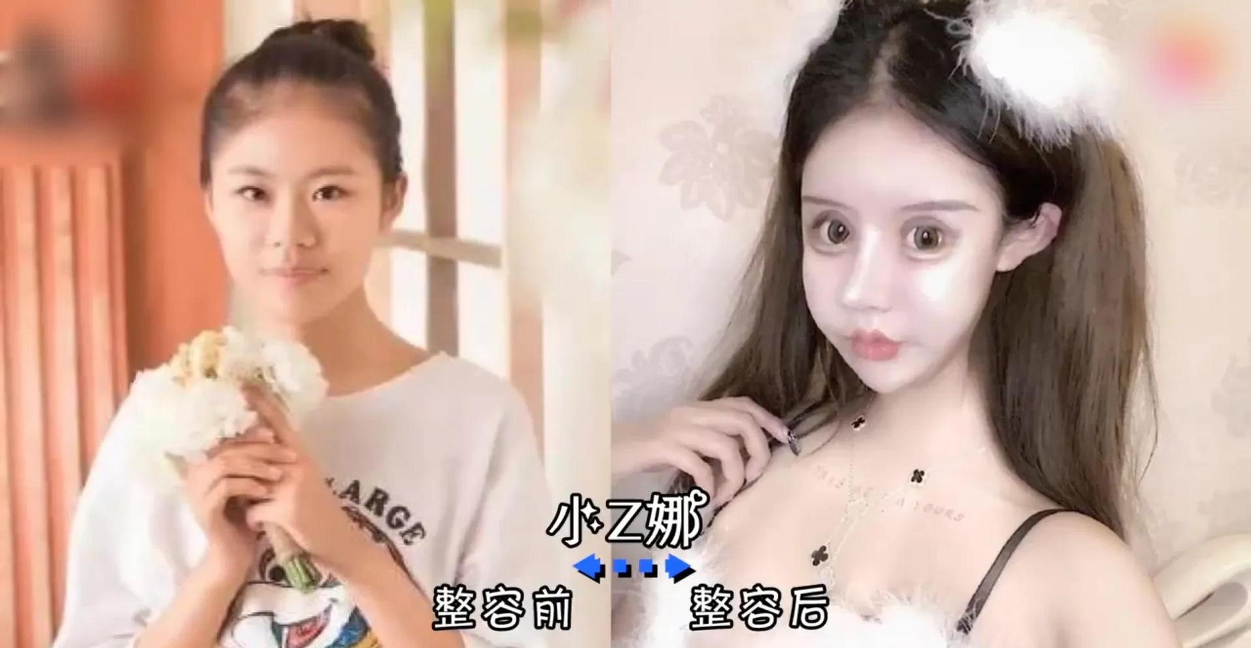 领动计划# 整容有风险,需谨慎 盘点9位不幸毁容的网红,有人面瘫,有人