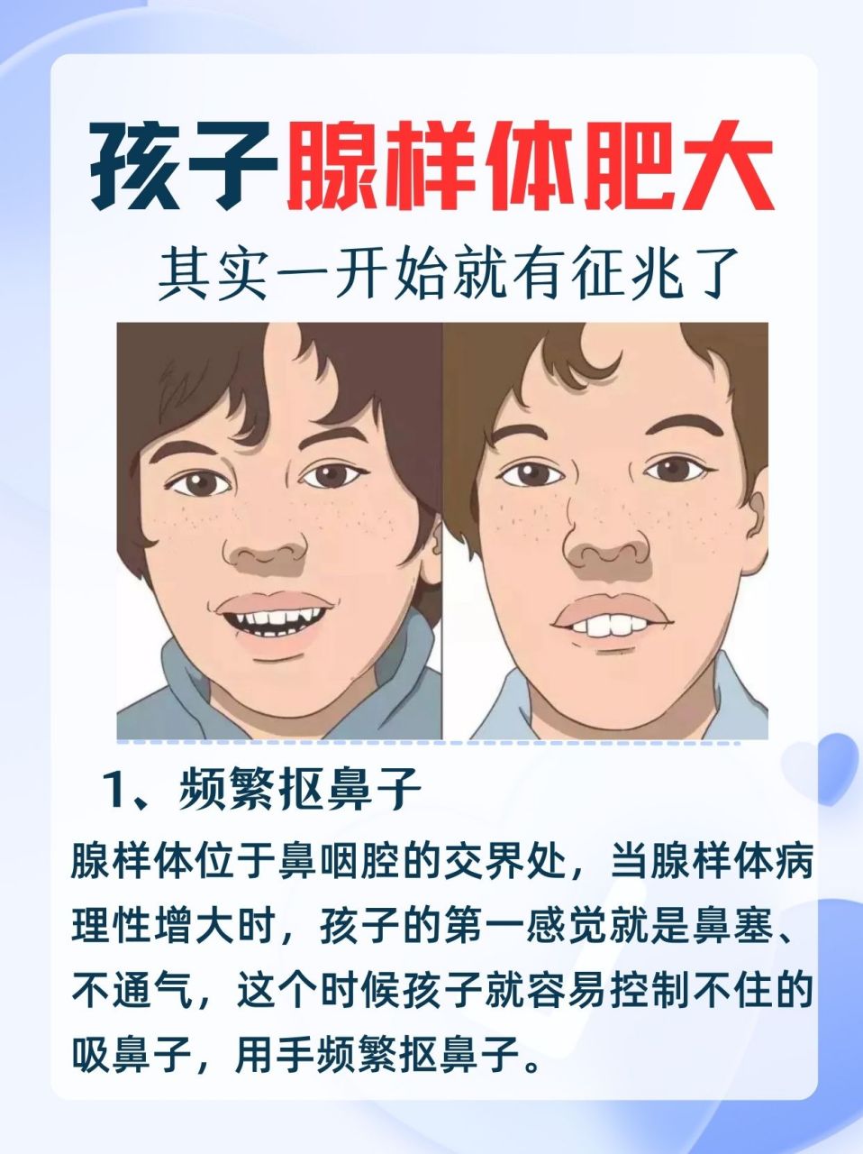 腺体肥大什么症状图片图片