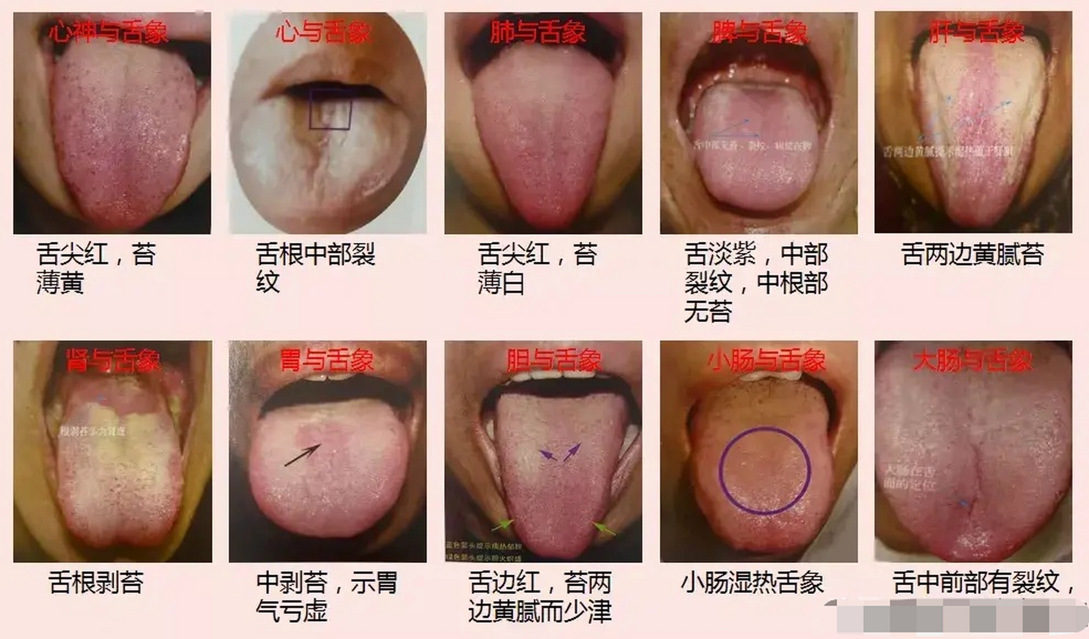 中医舌诊诊断学,你是肾阴虚还是肾阳虚? 望舌象:要分舌质,舌色和舌苔.