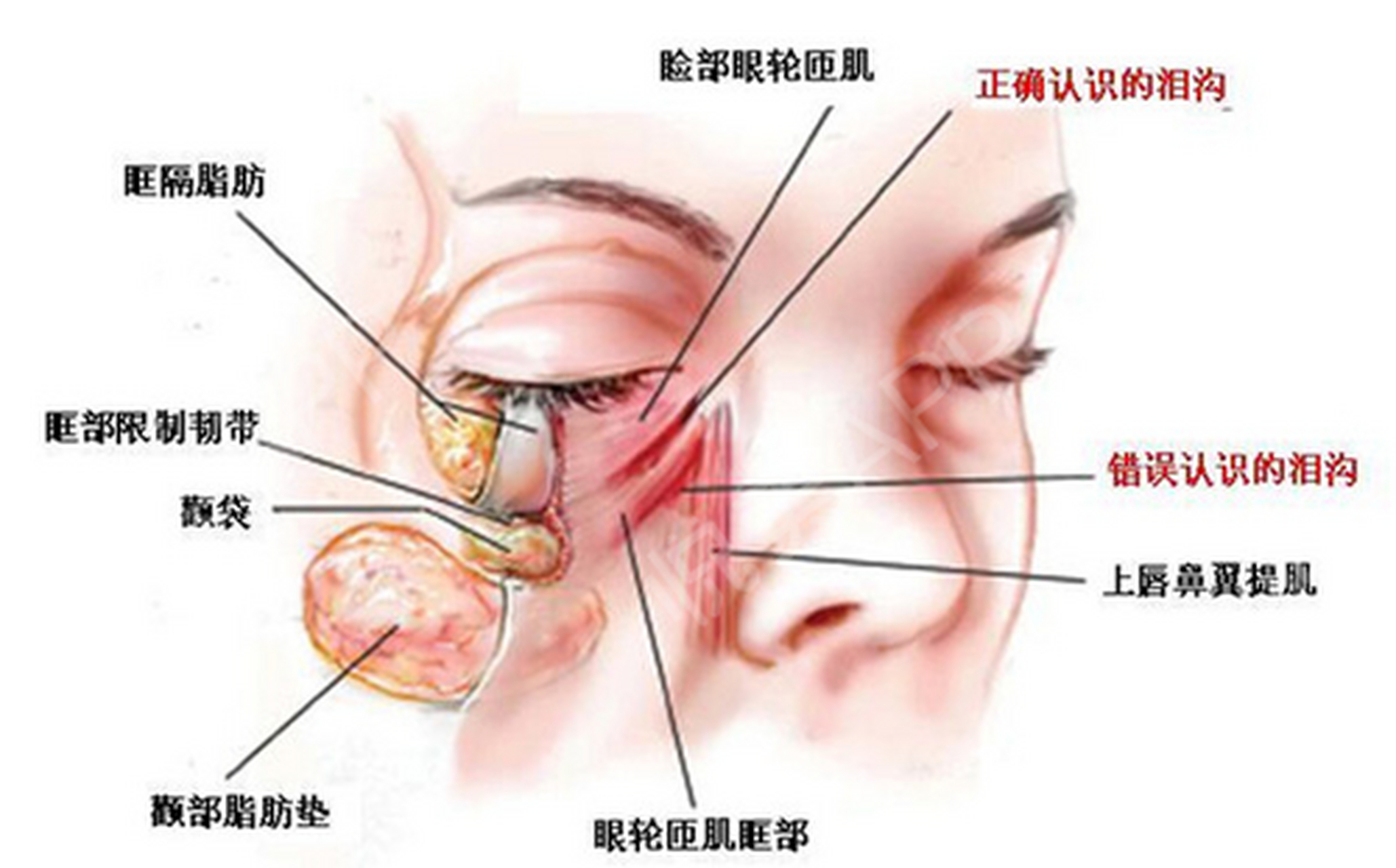 泪点的位置图片图片