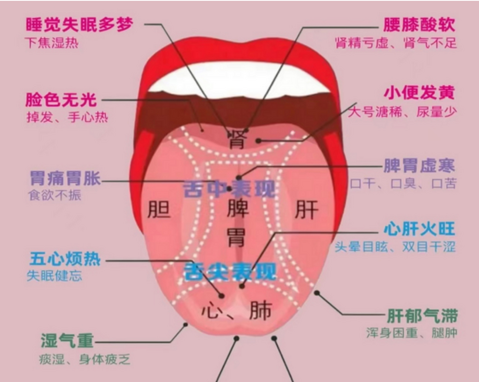 舌诊对应脏腑图解大全图片