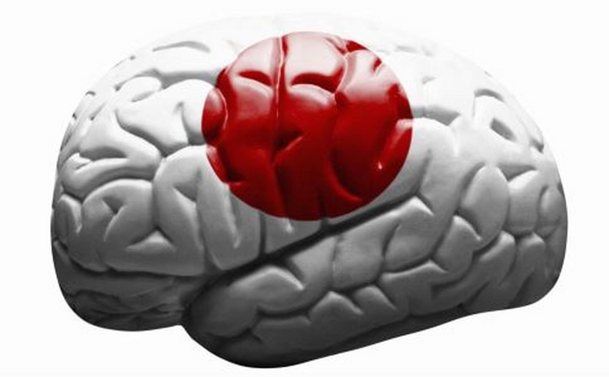 出现以下五大症状,考虑脑袋上长了瘤子,要尽早就医!