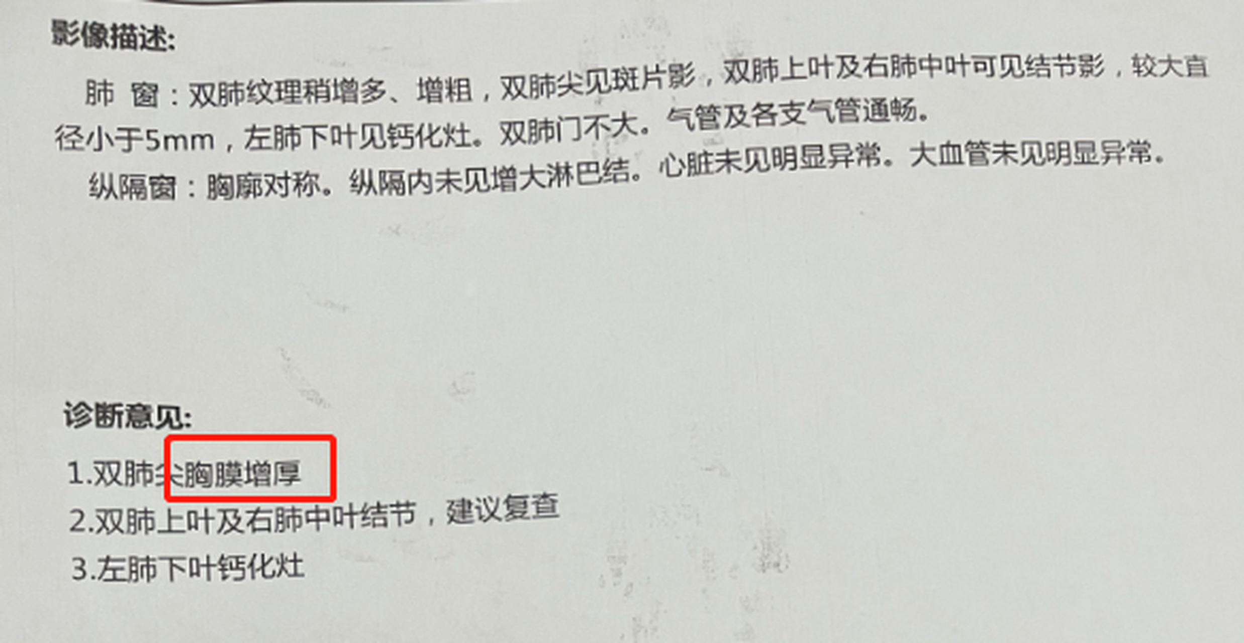 [赞同]成都市第三人民医院呼吸科吴迪医生公布,肺部ct检查报告的8个"