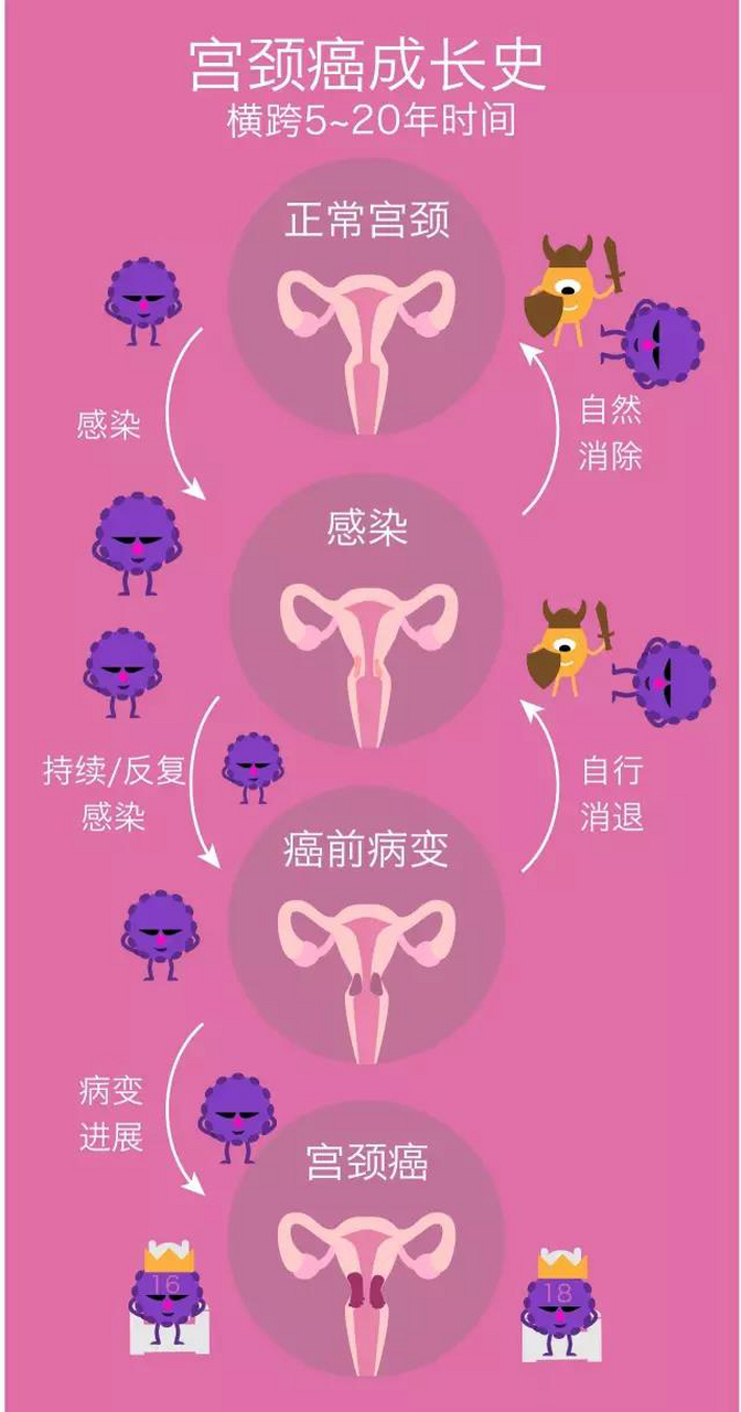 宫颈癌早期症状 表现图片