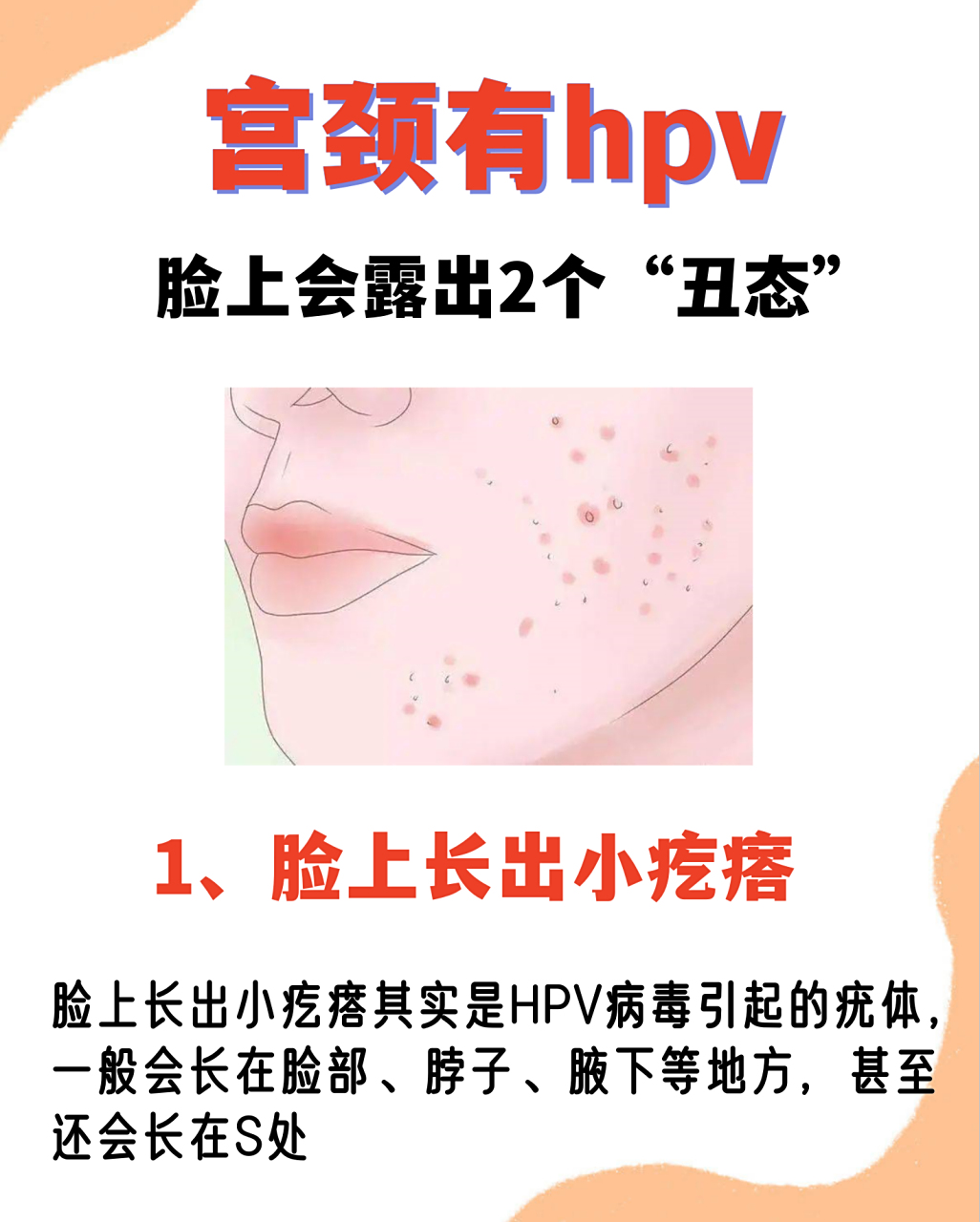 宫颈有hpv,脸上会露出2个"丑态"