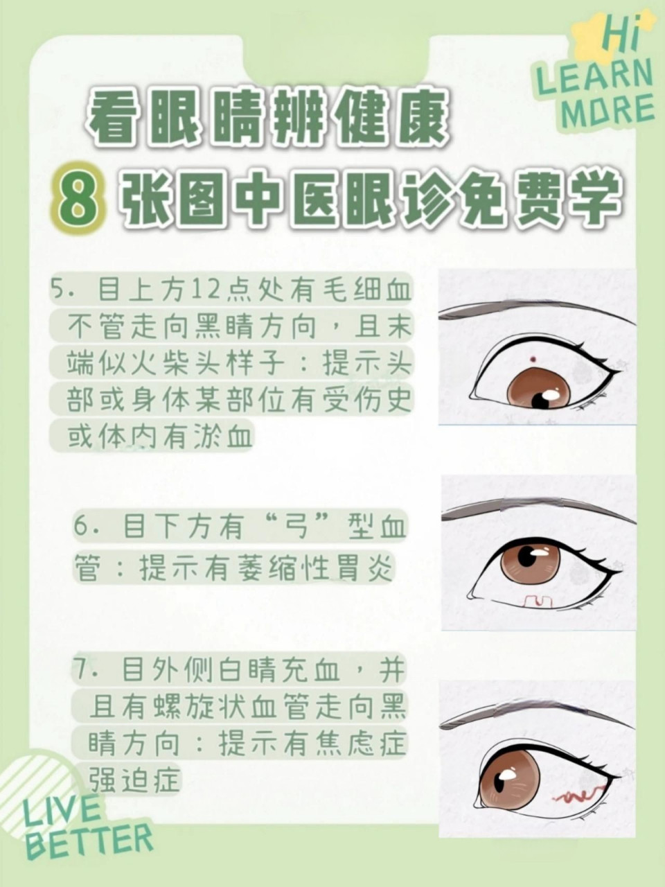 跟中医学眼诊60158张图教你眼睛看健康92  我发现很多宝宝对中