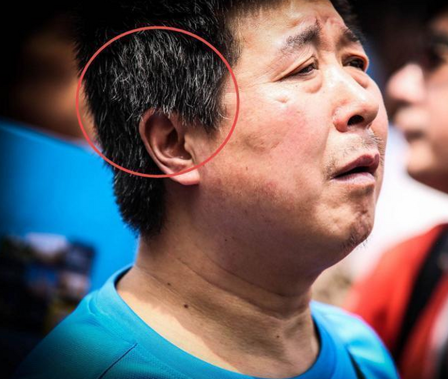 这是肝在向你"求救",养肝护肝1招解决】 白发会让人看起来显老,不精神